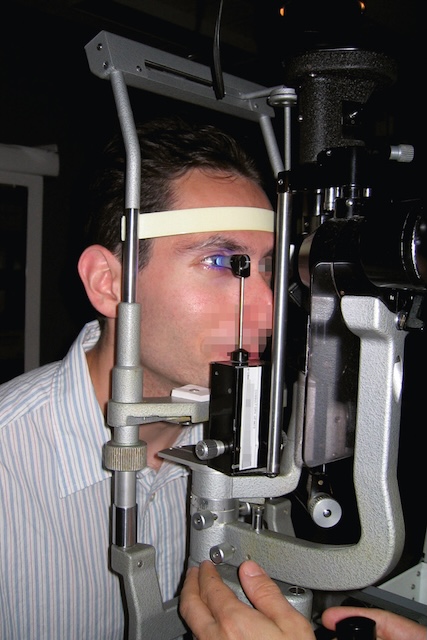 Mesure clinique de la pression intraoculaire par aplanation à l’aide d’un tonomètre sur lampe à fente, réalisée dans un cadre ophtalmologique.